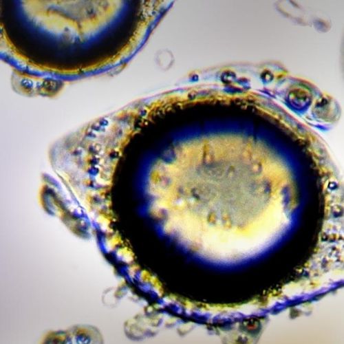 BMT® Kurkumin MIKROKAPSZULÁZOTT