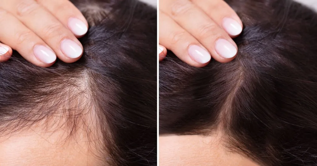 Hair.O Szérum 60 mL