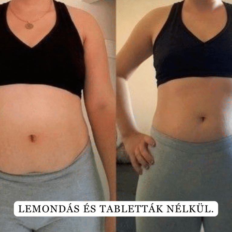 brand slimis bonboni za hujsanje lp 1 safe