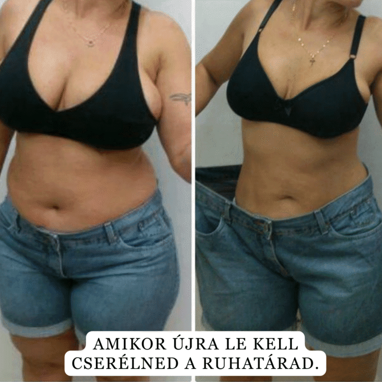 brand slimis bonboni za hujsanje lp 1 safe