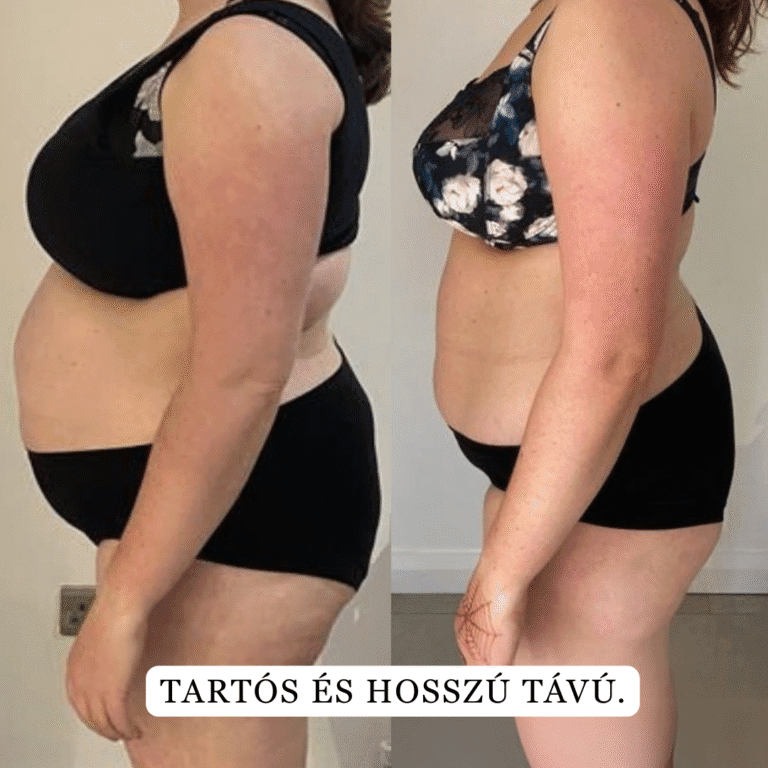 brand slimis bonboni za hujsanje lp 1 safe