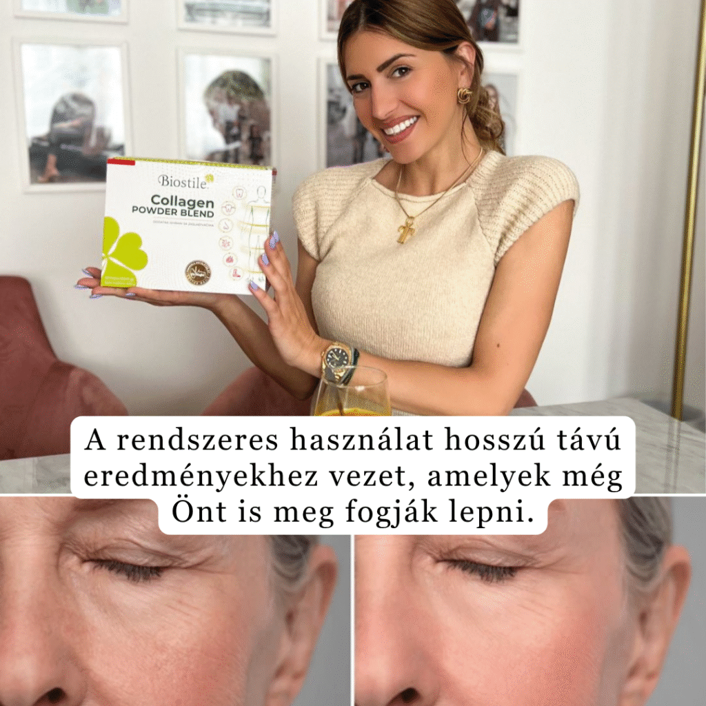 brand collagen s hialuronsko kislino darilo shaker mladosten videz lp 1