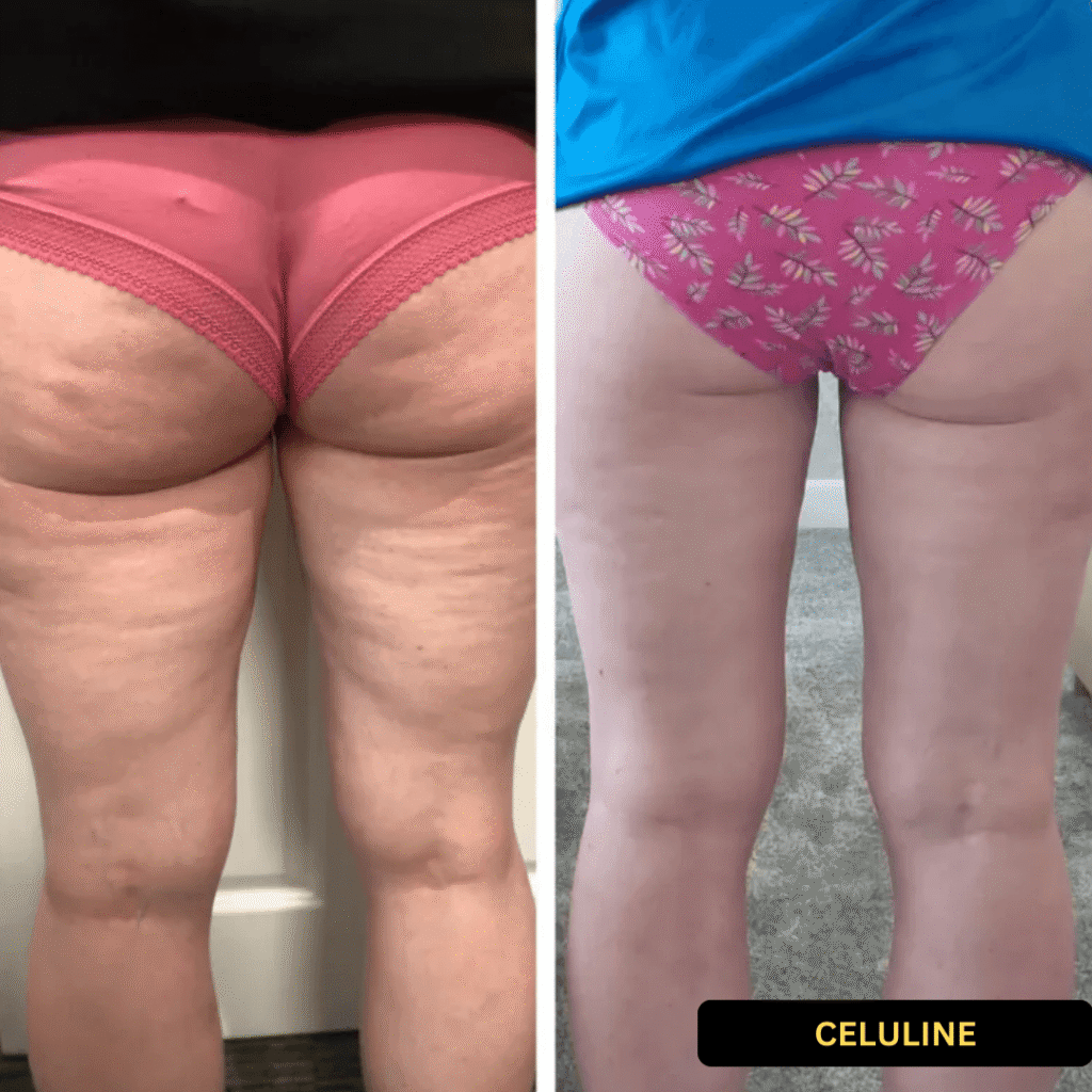 elp celuline 21 gratis